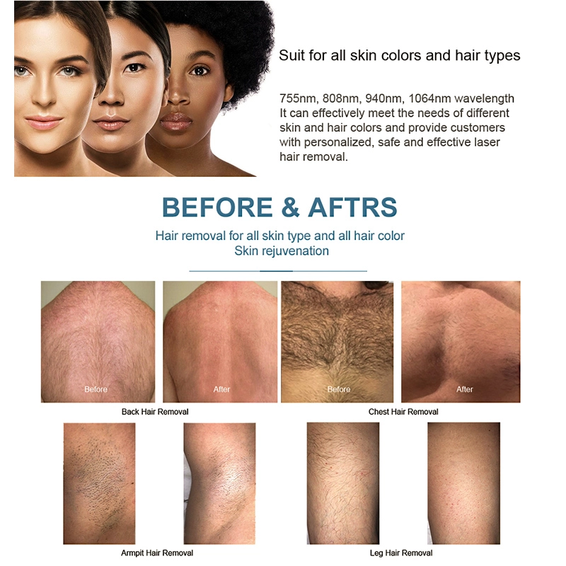 before &after comparison