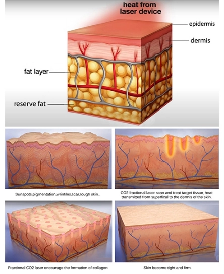 how it work
