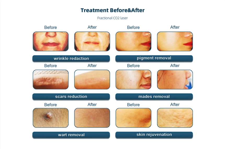 before and after