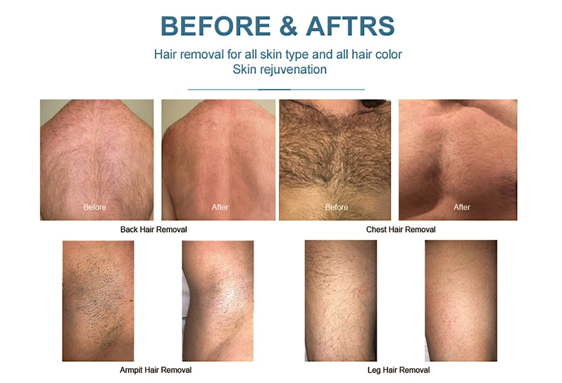 before and afters