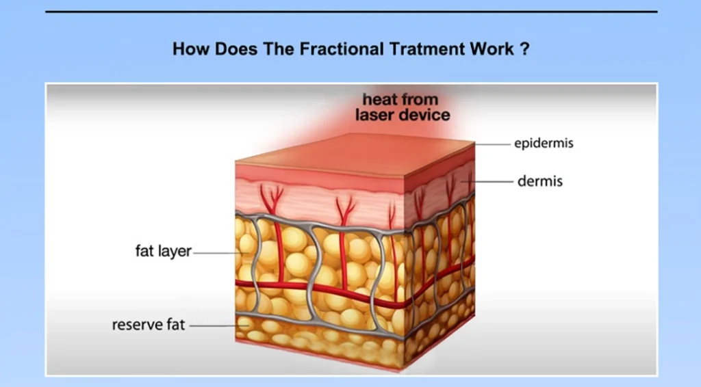 Treatment Application