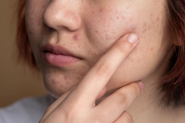 close-up-skin-pores-face-care-routine