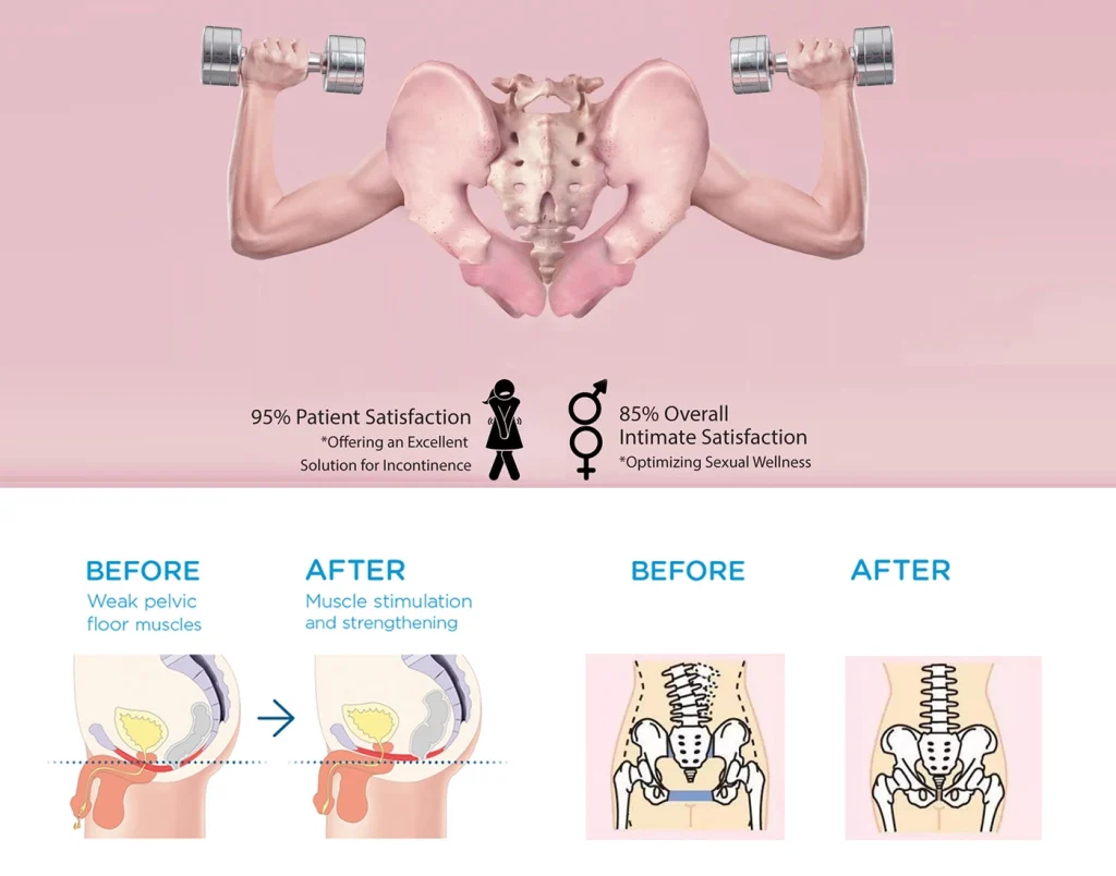 pelvic-floor-magchair-1