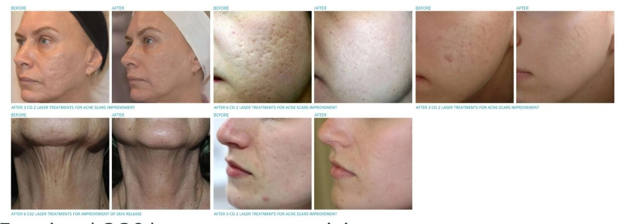 Before and after treatment comparison chart