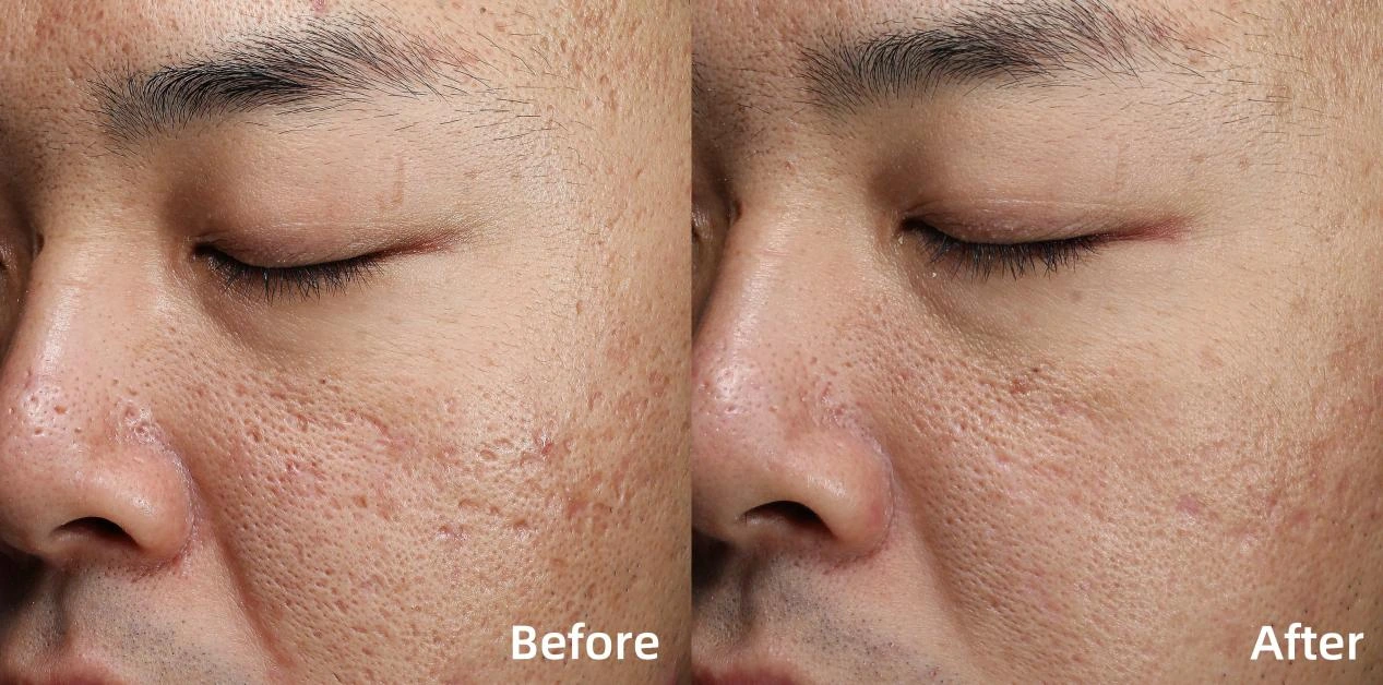 Before and after treatment comparison