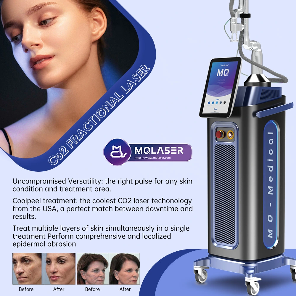 co2 laser machine