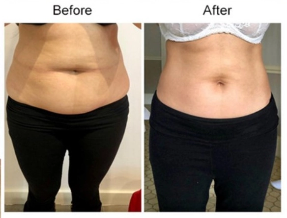 Before and after the treatment