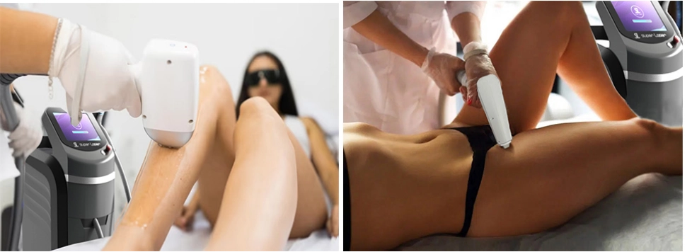 Collage of two images showing laser hair removal treatments on legs and bikini area