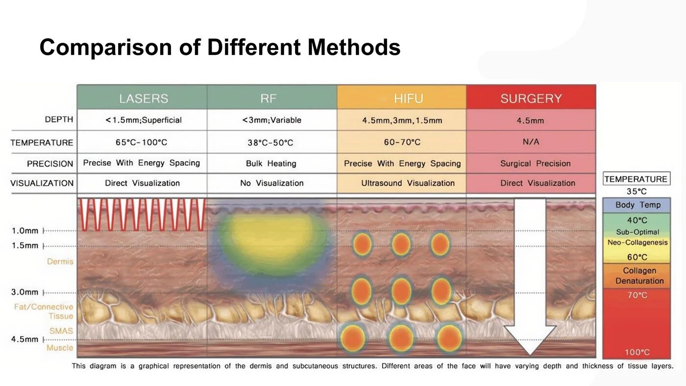 Comparison of Different Methods