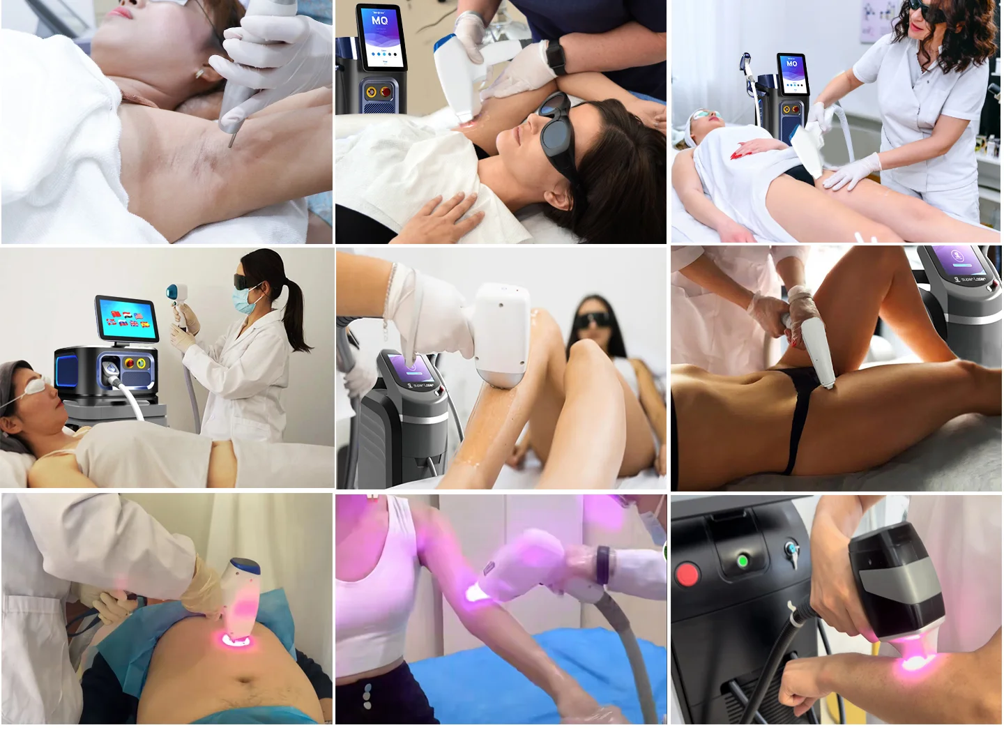 Laser Hair Removal feature