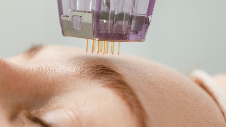 Microneedle,Mesotherapy