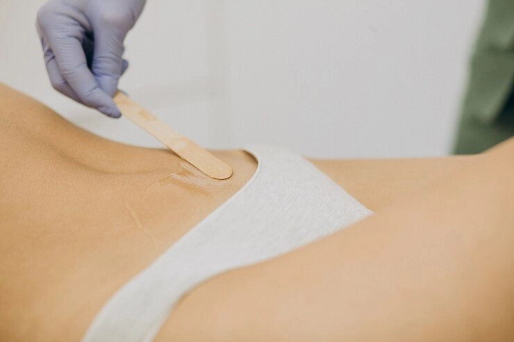 laser-epilation-hair-removal-therapy