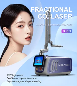 How CO2 Laser Treatments Justify Their Cost Over Time