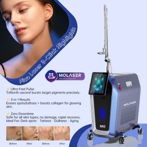 Picosecond Laser vs. Ablative Fractional Laser for Wrinkle Removal: The Modern Path to Smoother Skin