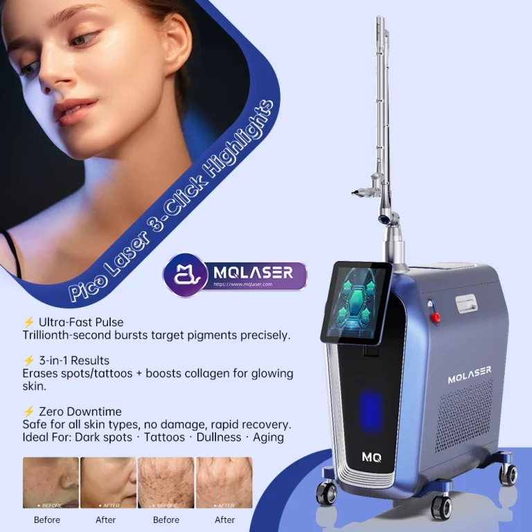 laser machine