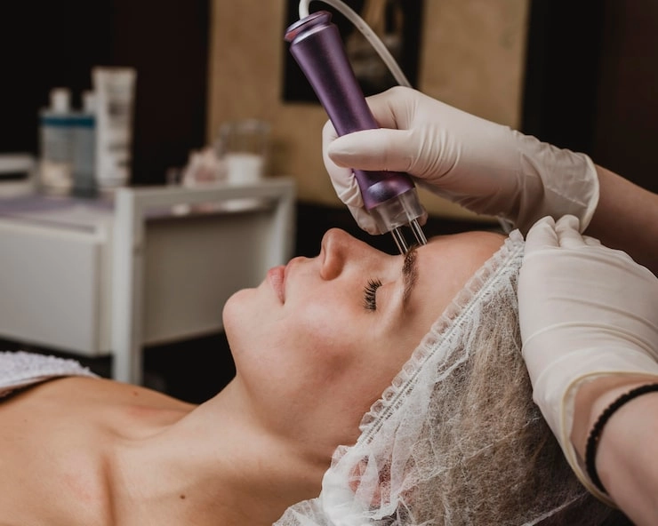 Core Technology of Medspa Fractional CO2 Laser Devices High-Speed Galvanometer vs