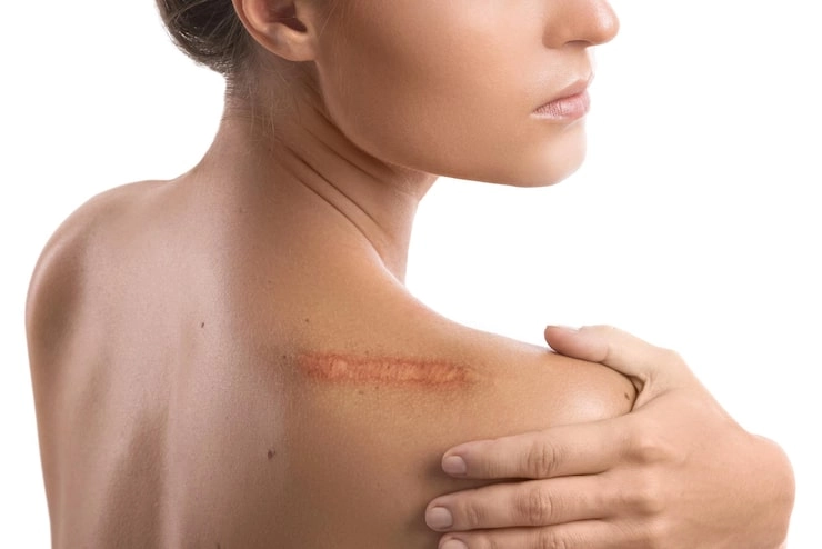 From Device Choice to Client Care How Clinics Build Cost-Effective CO₂ Scar Treatments