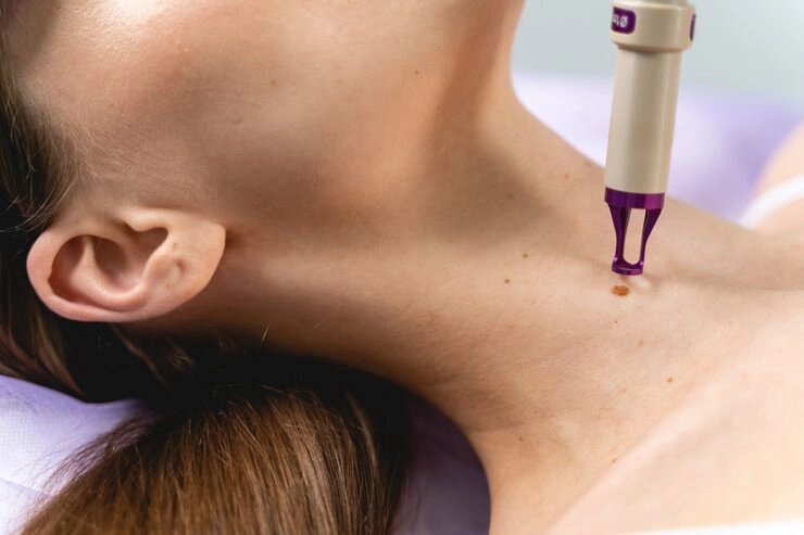 The Future of Aesthetics A Clinic's Guide to CO2 Laser for Scars, Rejuvenation & Women's Health