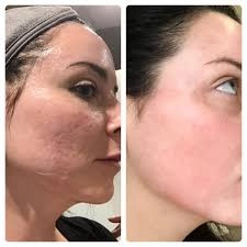 Contrast between the front and back of a woman's face