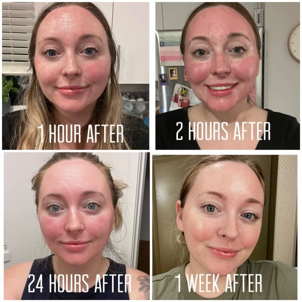 a woman's before-and-after comparison