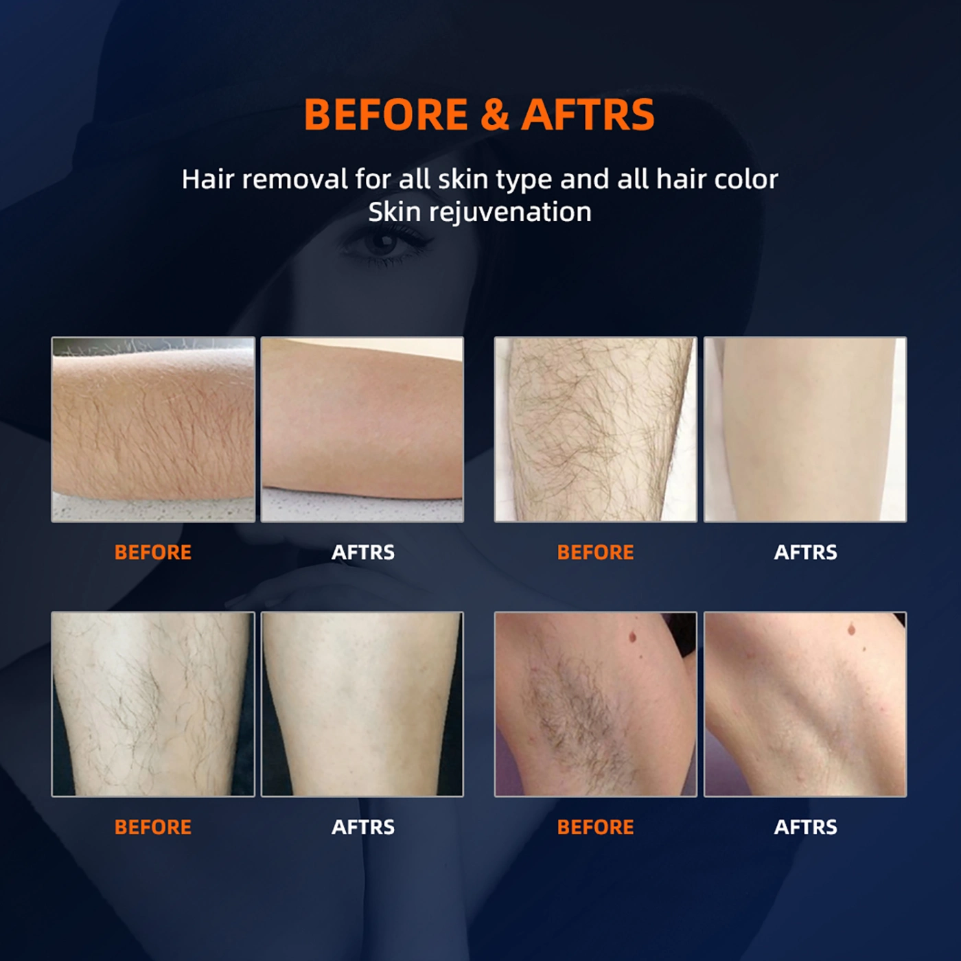before and after comparison of hair removal