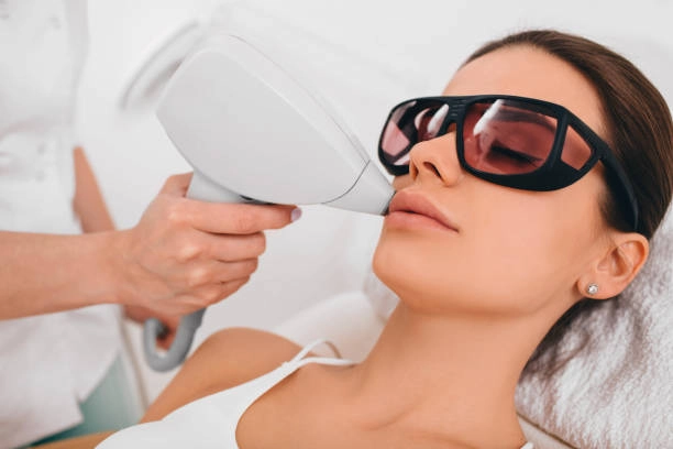  facial laser hair removal with a woman