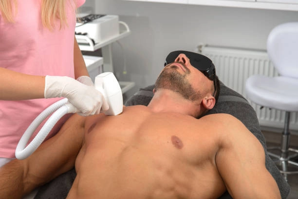 male hair removal