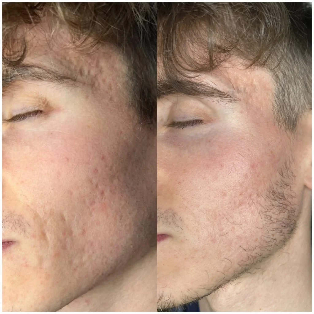 changes in a man's face before and after