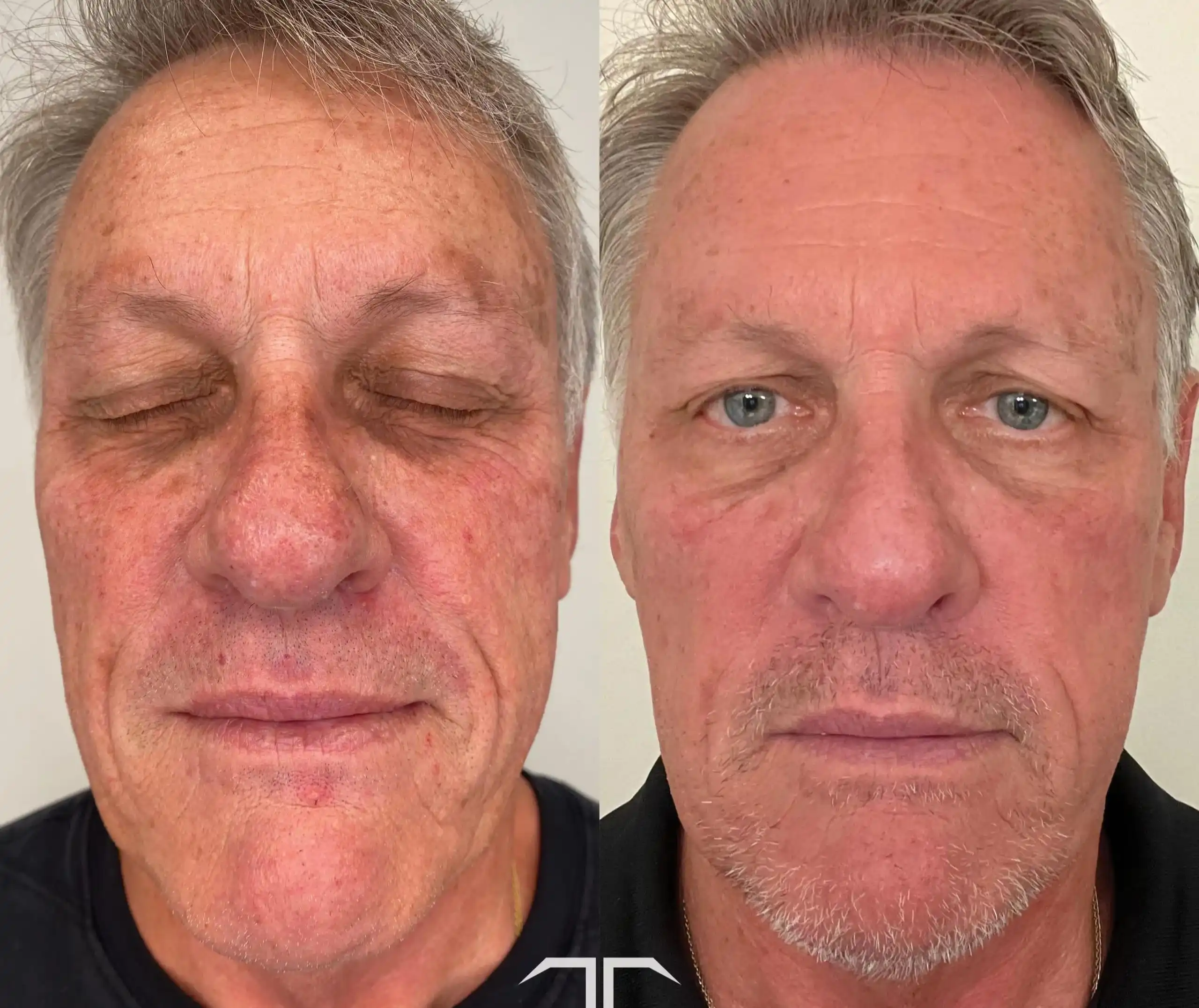 changes in facial appearance before and after