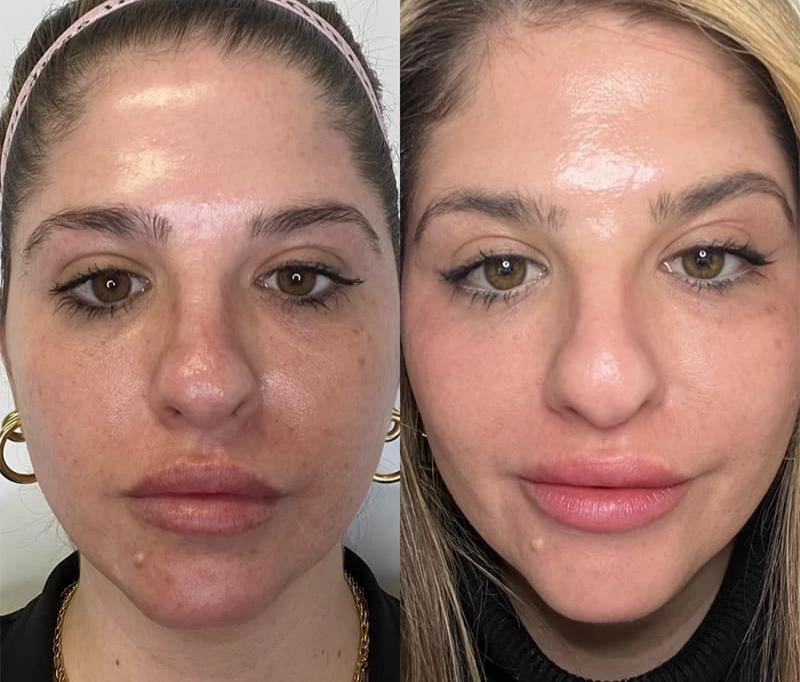 front-to-back changes in female face