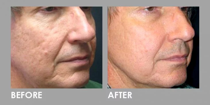 front-to-back changes in the male face