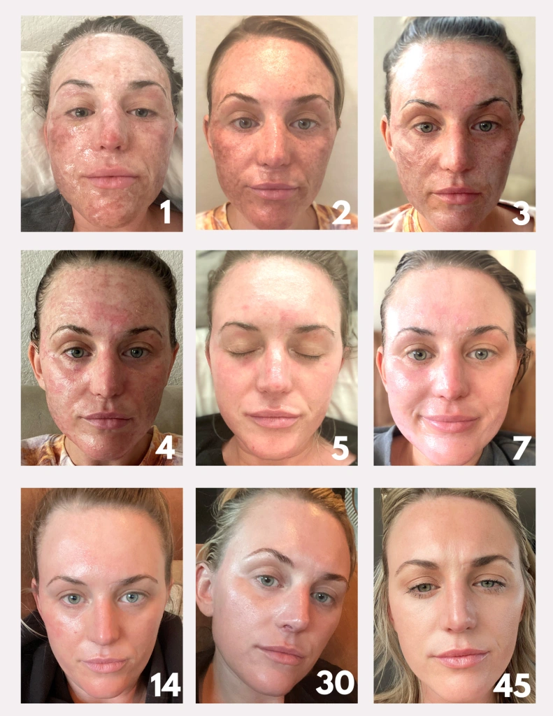 the process of a woman's face improving