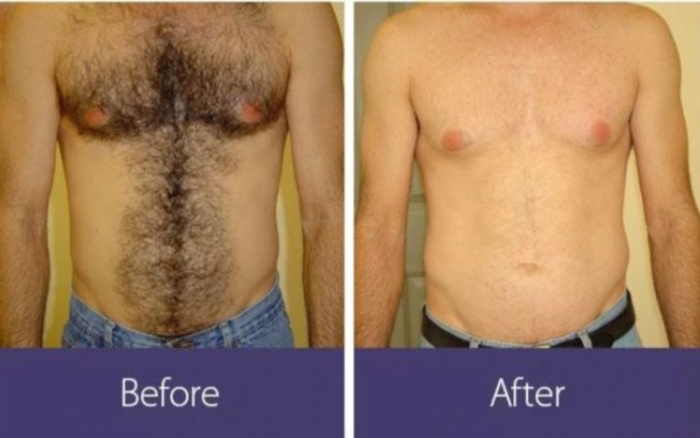 Before and after comparison of a man's body