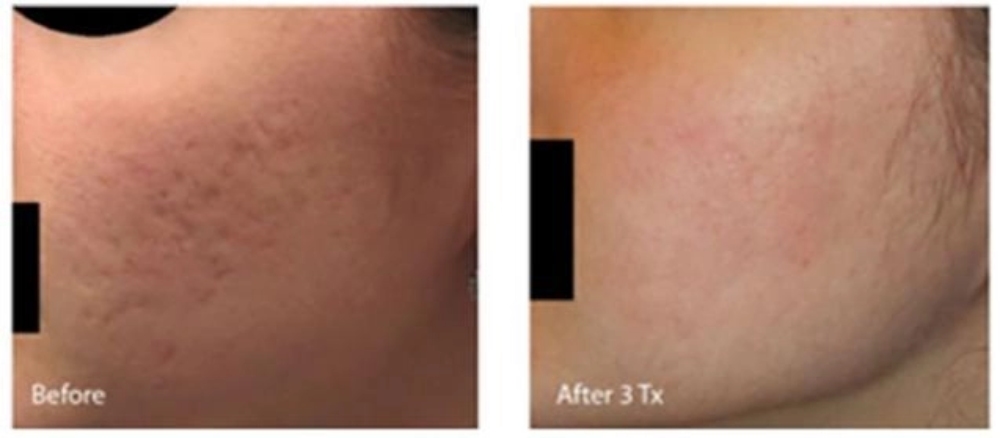 before and after changes in a woman's face