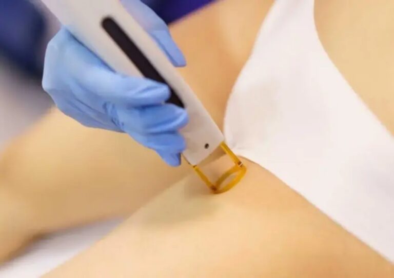 Alma Lasers Soprano Titanium vs MQLASER Alexandrite Laser Which Hair Removal Machine Fits Your Aesthetic Business