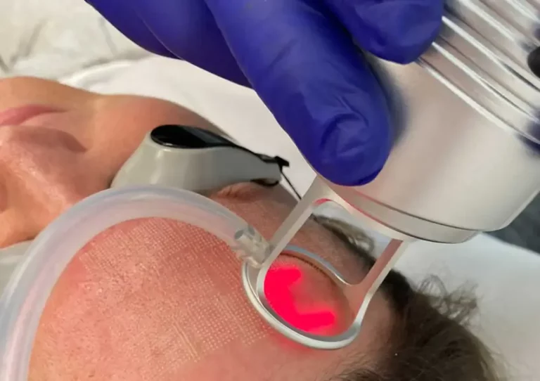 Alma Pixel CO₂ vs MQLASER DIATERMOLOGIE A Practical Buyer Comparison