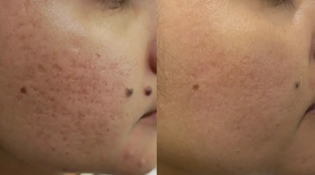 facial comparison