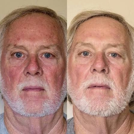 male facial comparison