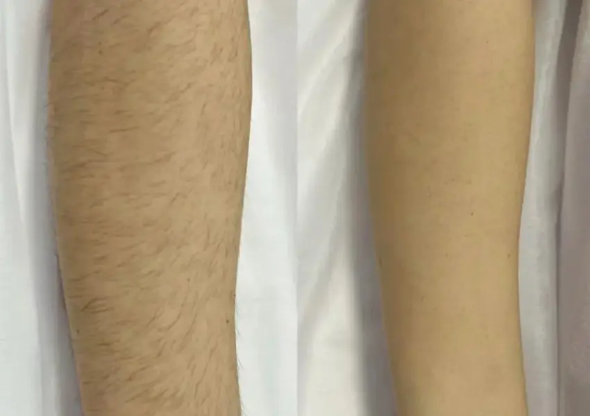 arm comparison