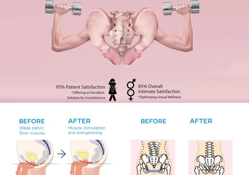 before and after DEPMAX treatment