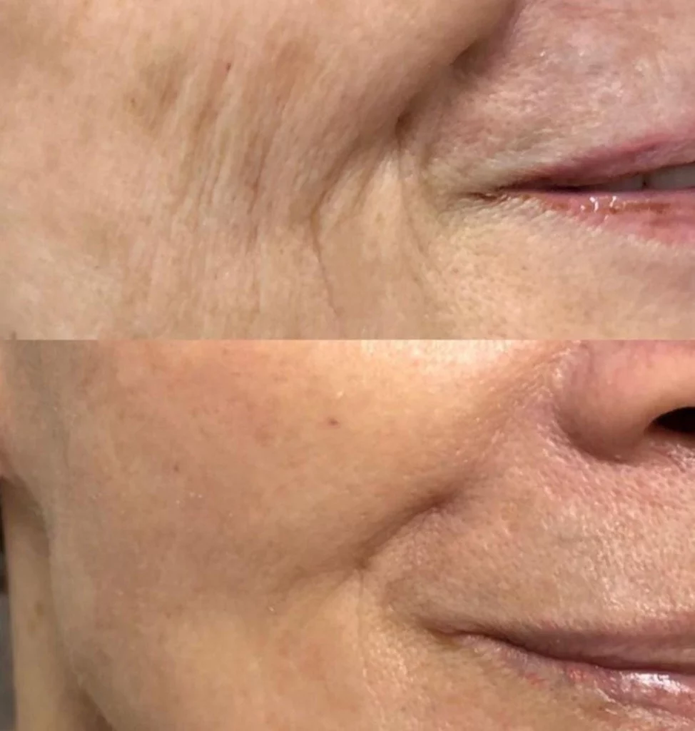 changes in a woman's face