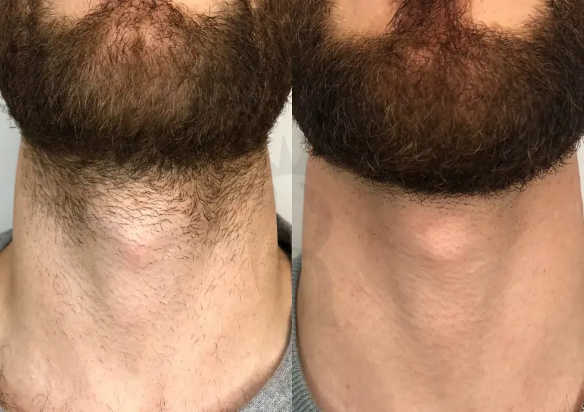 comparison of a man's neck