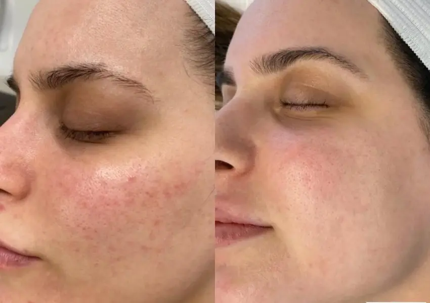 comparison of a woman's face