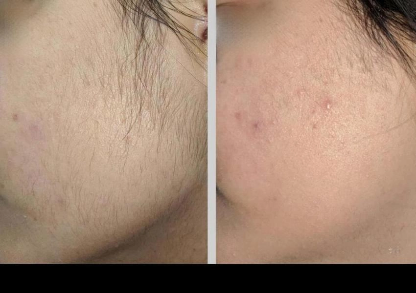comparison of a woman's face