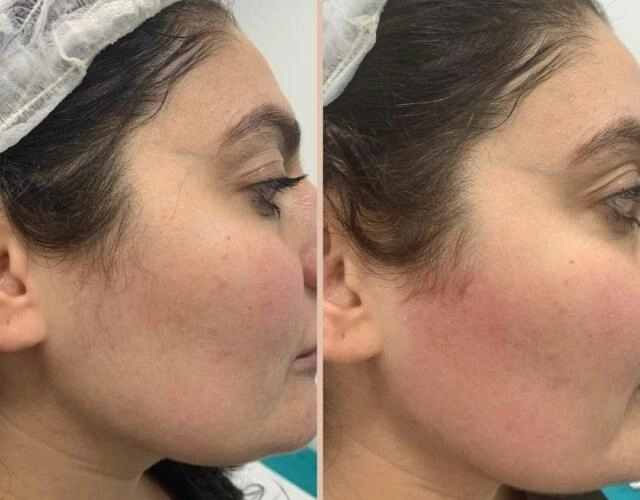 comparison of a woman's face