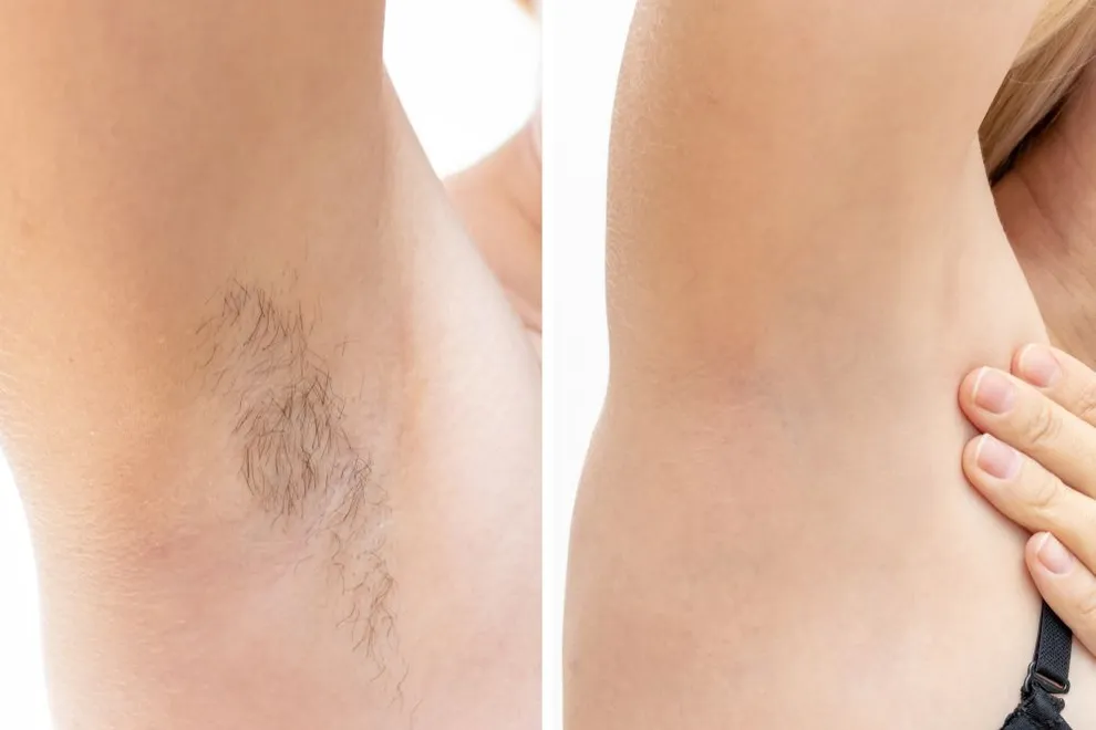 comparison of woman's armpits