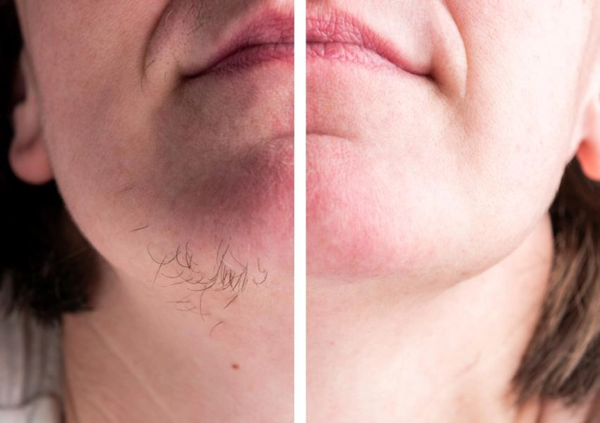 face comparison