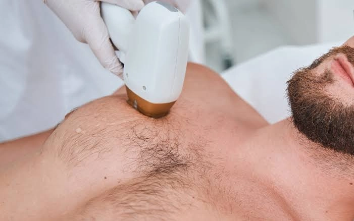 full body hair removal for a man