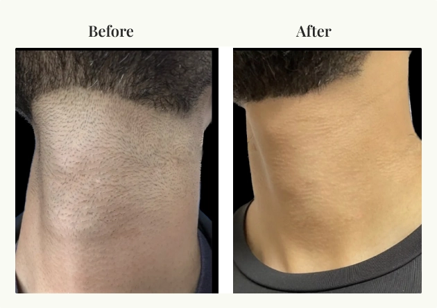 man's chin comparison