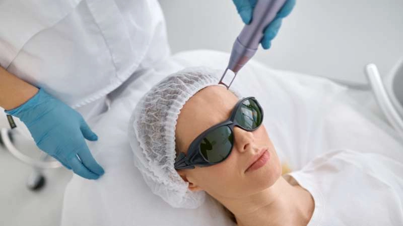 CO₂ laser resurfacing before after